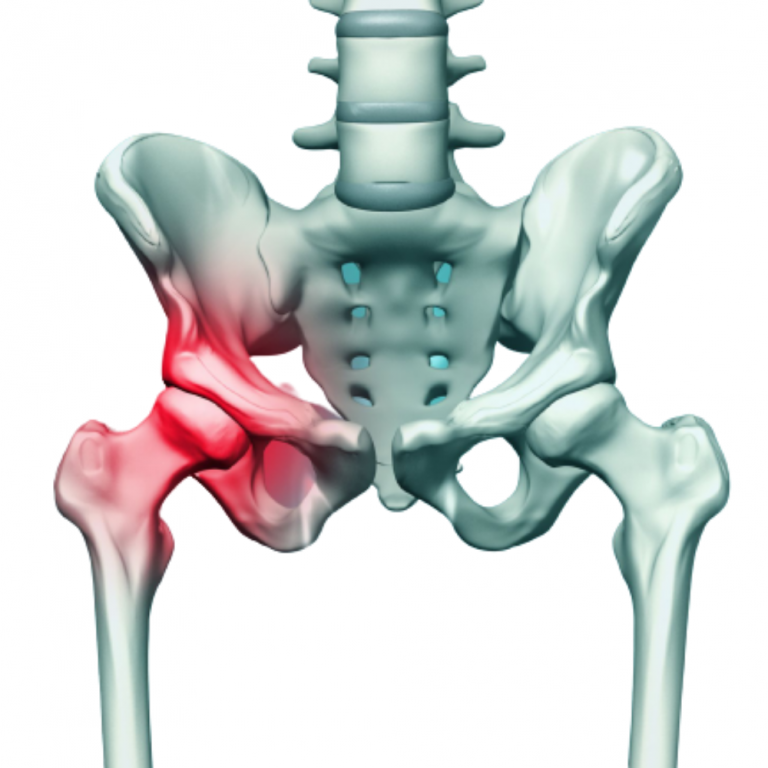 Pelvic and Acetabular – Dr DP Sharma