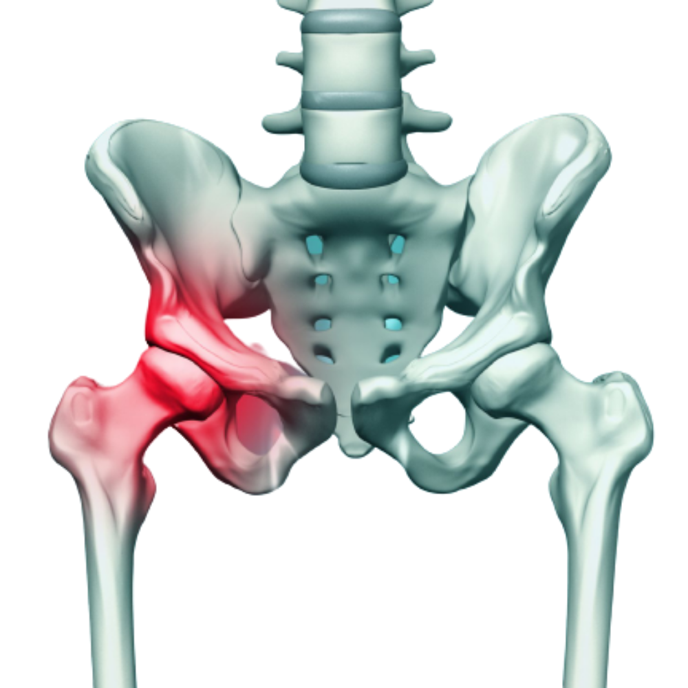 Pelvic and Acetabulum image @Dr DP Sharma