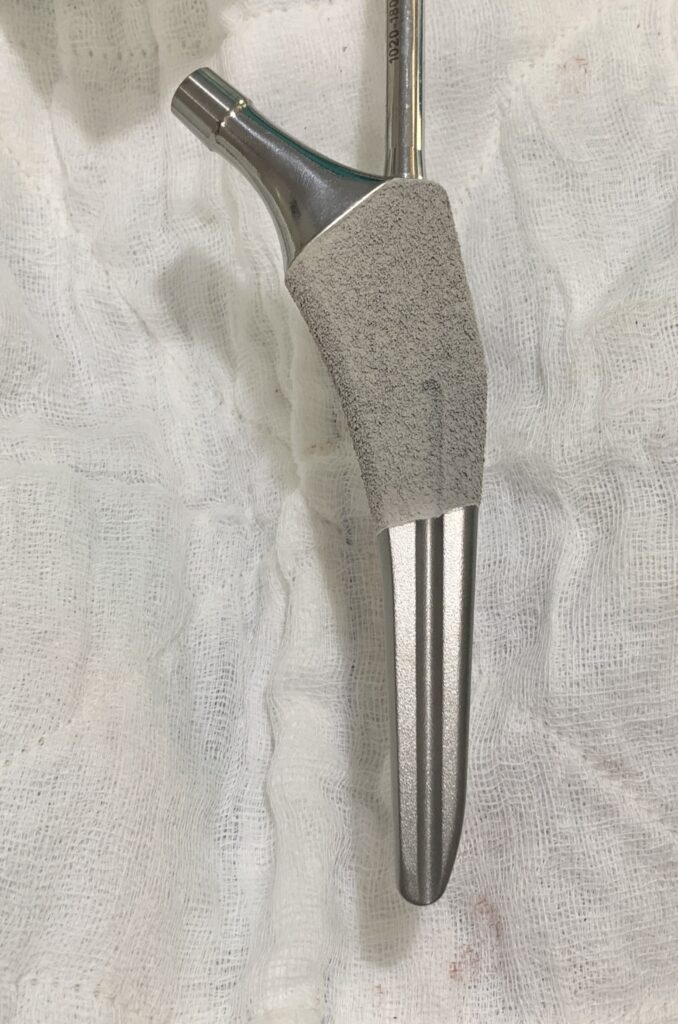 Hip Replacement Surgery related tool